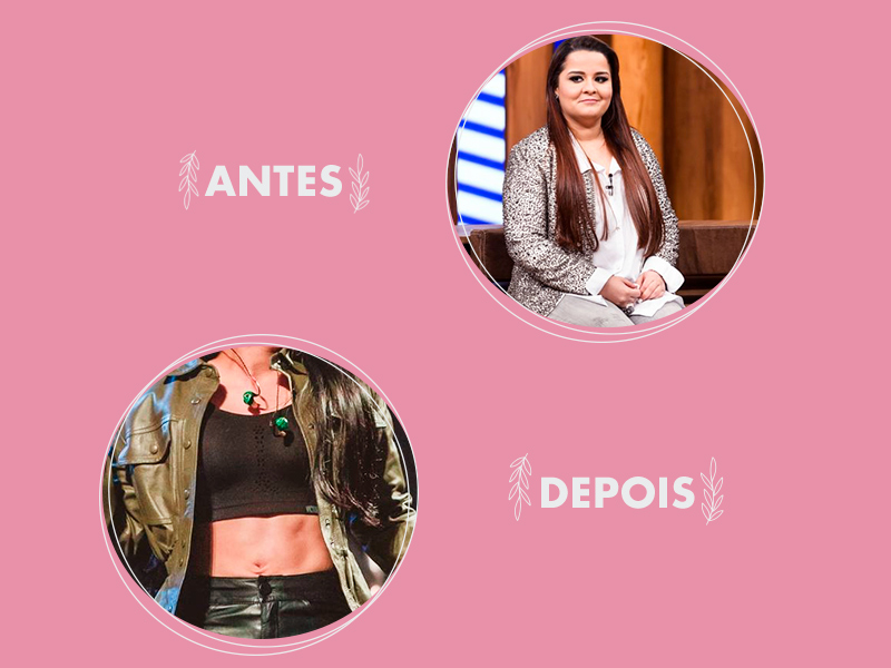 Antes e Depois plástica do abdômen da Mara antes e depois plastica do abdomen