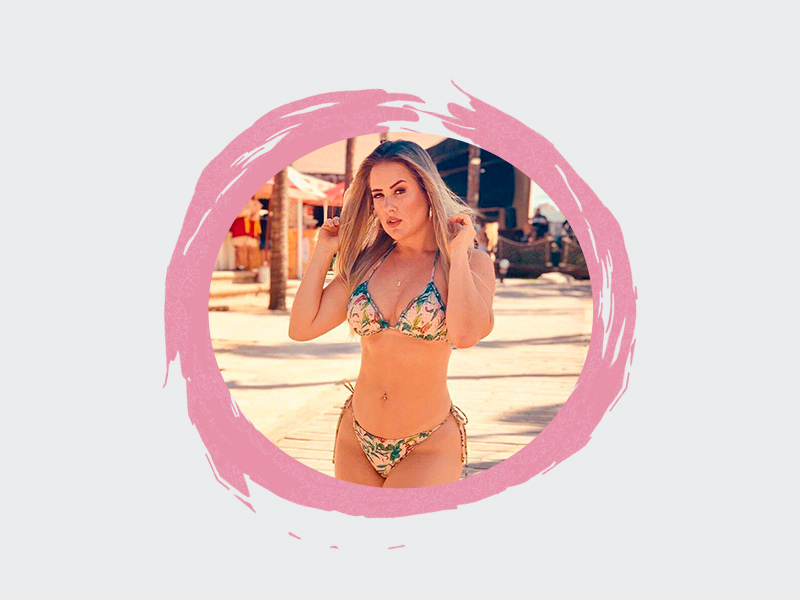 Cirurgia do Abdômen de Patrícia Leitte Ex-BBB Patrícia Leite mostrando o antes e depois de sua abdominoplastia em uma praia, ela usa um biquíni estampado e está posando para foto.
