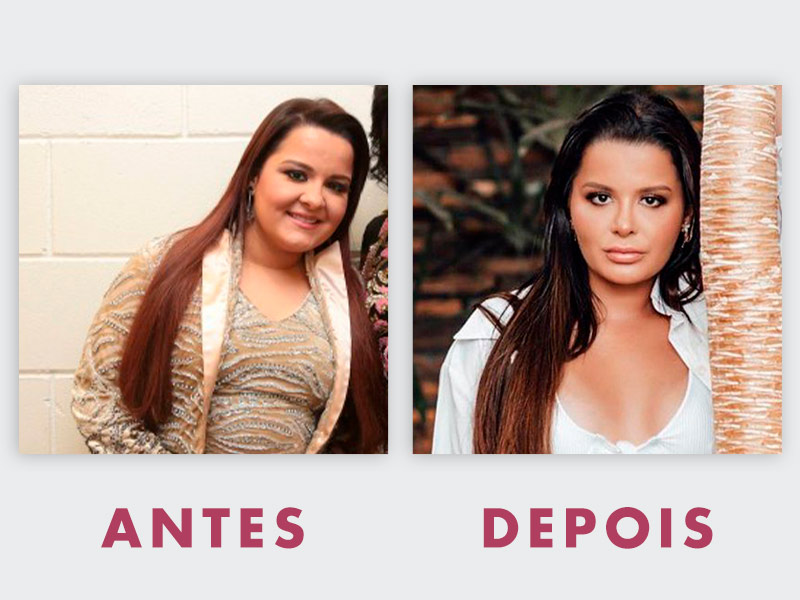 Confira o antes e depois de algumas celebridades, Famosos