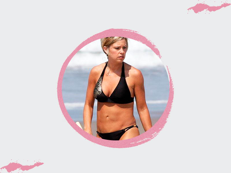 Resultado da cirurgia do abdômen de Kate Gosselin cirurgia-abdomen-kate-gosselin