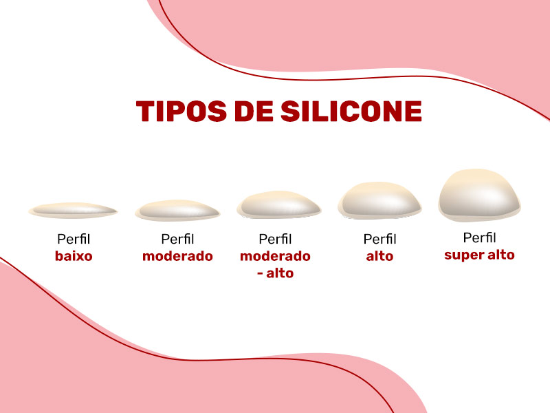 Tipos de prótese de silicone pode definir um resultado diferente: redondas, cônicas e gota