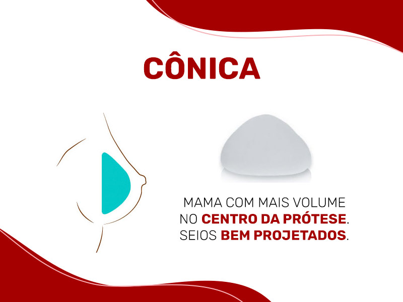 Ilustração com a prótese cônica, o antes e depois é algo mais natural, porém projetado