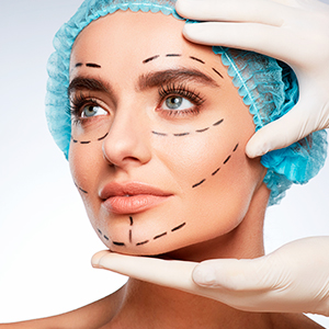 Lifting Facial: o que é e como funciona a cirurgia plástica no rosto?