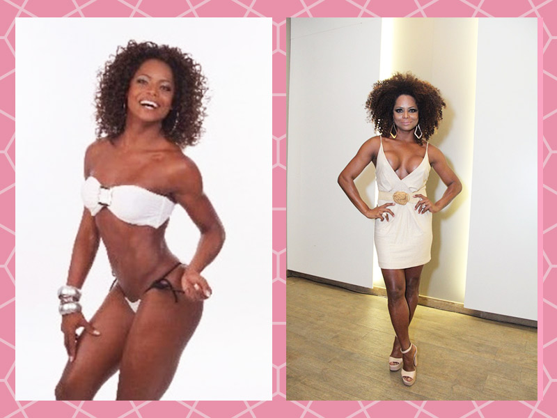 Antes e depois da Adriana Bombom Resultado antes e depois da prótese de 300 ml da Adriana Bombom, é possível ver que o depois ficou bastante marcado