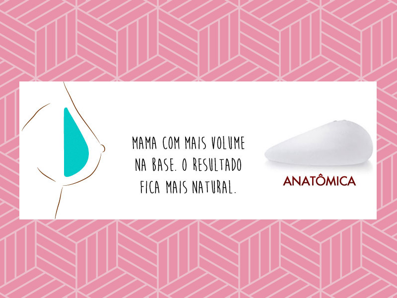 Silicone Natural ou Prótese Anatômica em Gota: antes e depois O antes e depois do silicone natural pode ser dado com a prótese de gota
