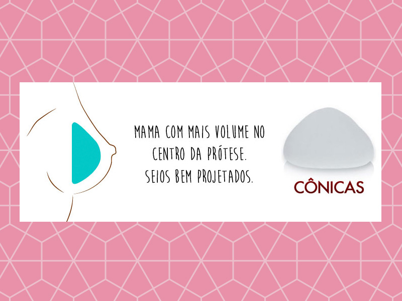 Prótese Cônica ou Silicone perfil super alto: antes e depois Ilustração com a prótese cônica, o antes e depois é algo mais natural, porém projetado