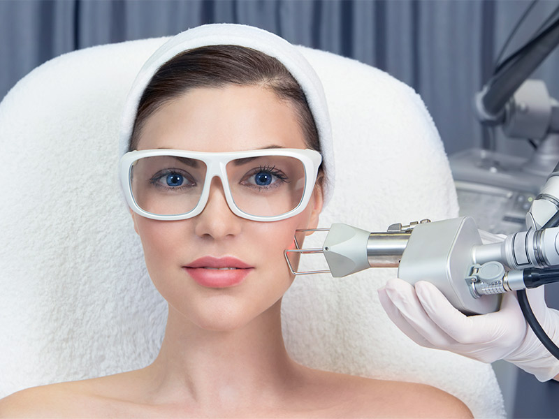 Paciente de óculos recebendo o laser CO2 para rejuvenescimento facial