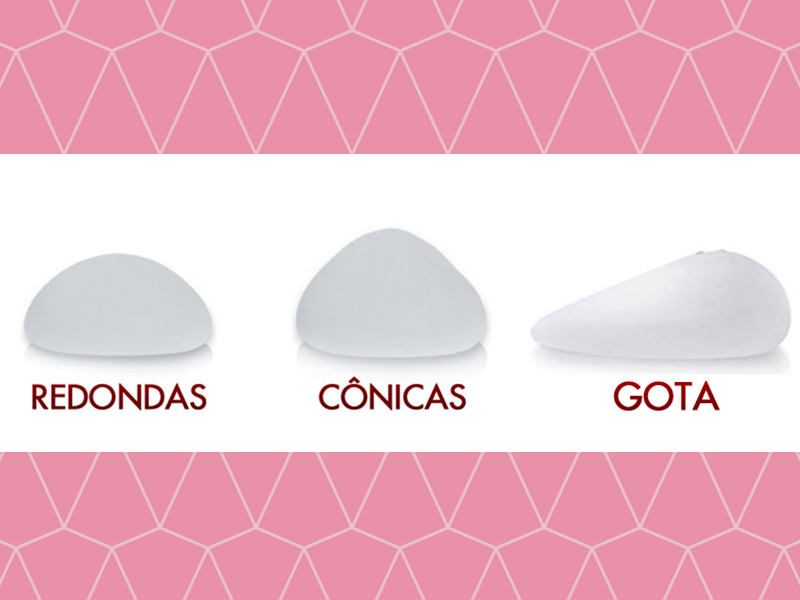 Tipos de prótese de silicone: antes e depois Tipos de prótese de silicone pode definir um resultado diferente: redondas, cônicas e gota