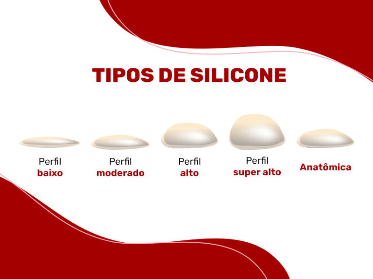 Silicone antes e depois - Veja fotos reais de pacientes!