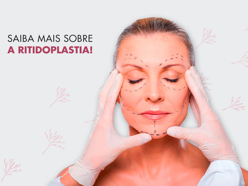 Ritidoplastia: conheça a cirurgia que vai te deixar com o rosto mais jovem e bonito! ritidoplastia rosto