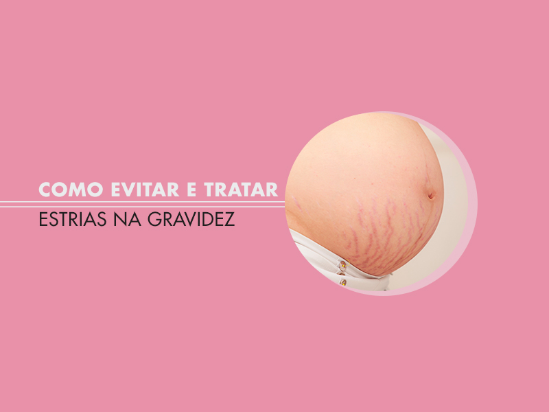 Como evitar e tratar estrias na gravidez? Conheça os primeiros sinais, cremes, óleos e a cura definitiva! estrias gravidez barriga