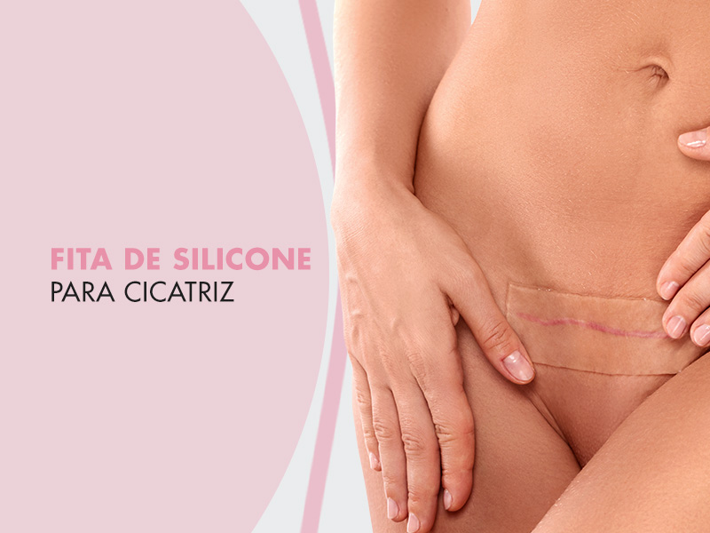 Fita de Silicone para Cicatriz hipertrófica e queloide: o que é, como usar, valor e muito mais! fita silicone cicatriz
