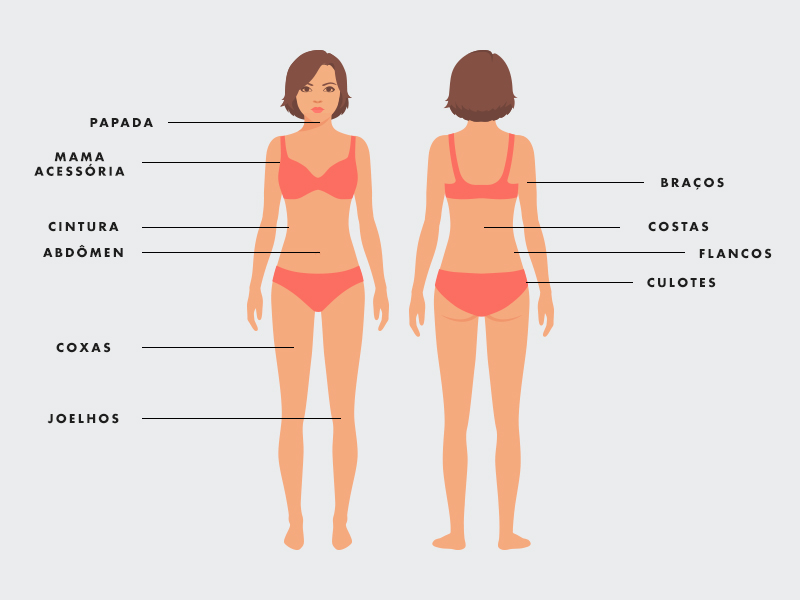 ilustração coma a Diferença da Abdominoplastia para a Lipoaspiração regiões que são feitas