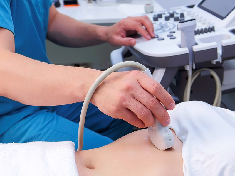 Imagem de mulher fazendo ultrassom para descobrir se tem diástase abdominal
