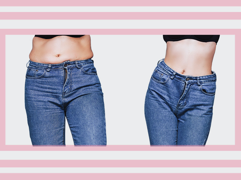 Abdominoplastia: os riscos devem te impedir de realizar o seu sonho? antes e depois da abdominoplastia sem medo