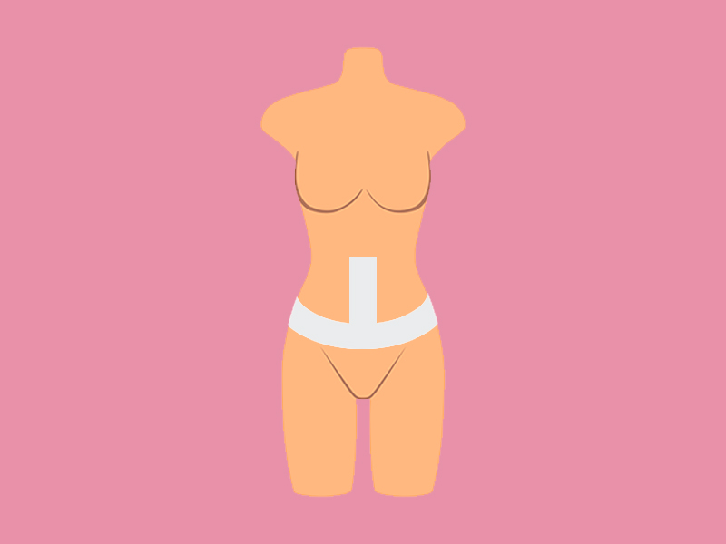 Ilustração de fita de silicone para cicatriz de abdominoplastia no abdômen