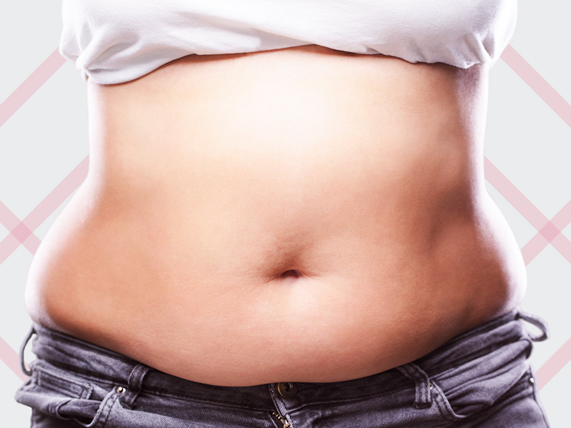 O que é Lipoescultura? cirurgia tira gordura coloca outro lugar