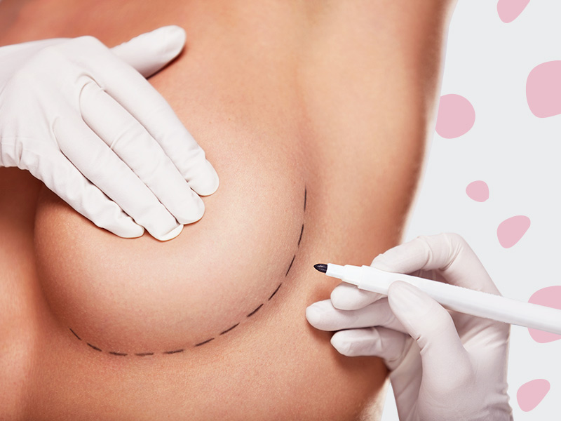 Como é feita a cirurgia de explante de silicone? cirurgia retirada protese silicone