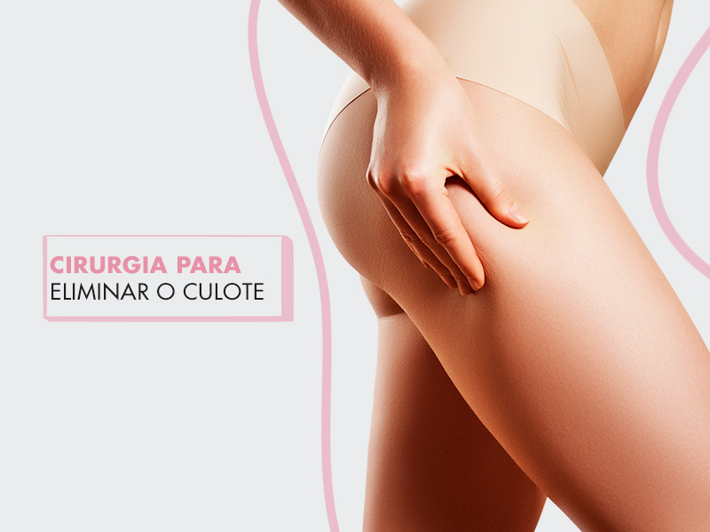 Culote: o que é e como eliminar a gordura na lateral da coxa com lipoaspiração culote