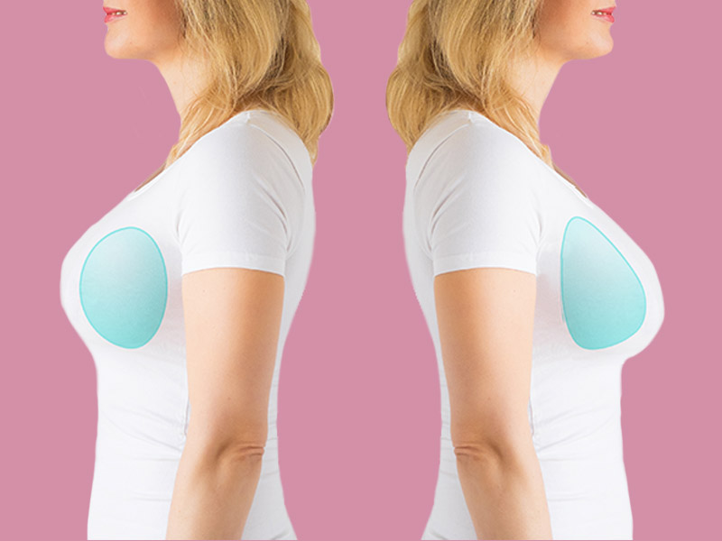 Como deixar o silicone mais natural ou silicone marcado? mostrando o silicone marcado e o silicone natural