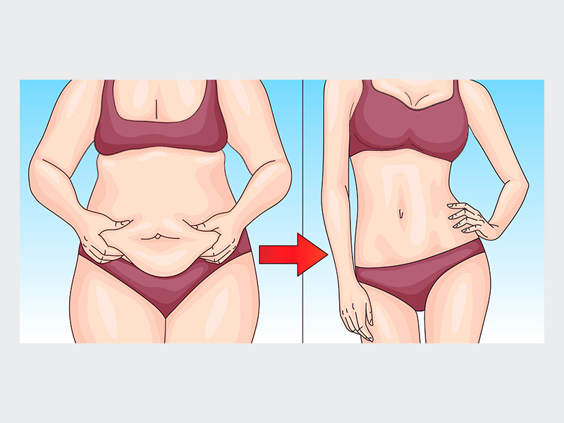 ilustração com o antes e depois da abdominoplastia com mamoplastia