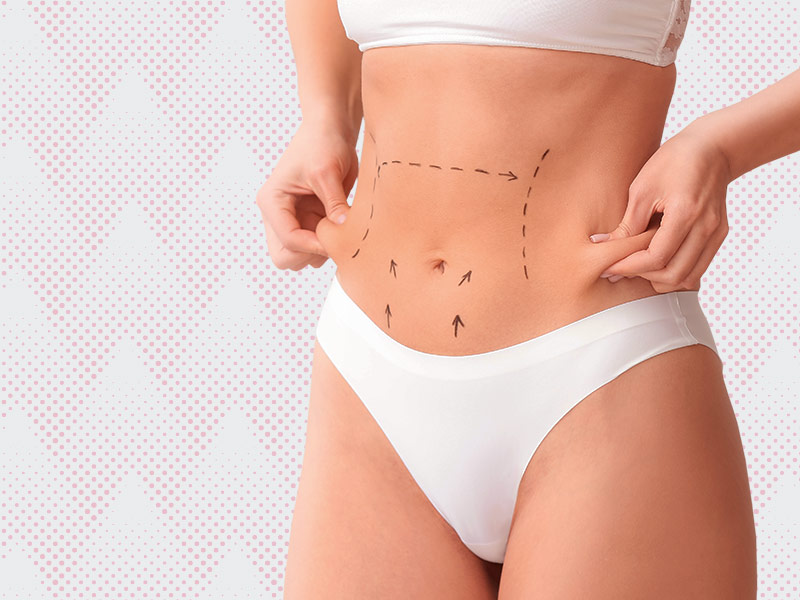 Lipoaspiração abdominal lipoaspiracao abdominal