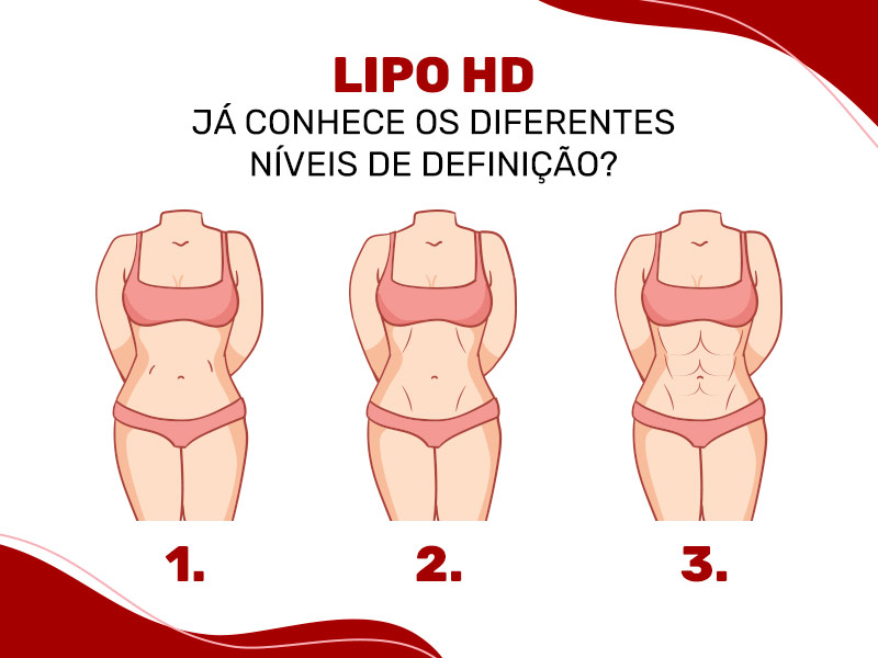 Ilustração mostrando os três tipos de lipo hd, que são de baixa, média e alta definição.