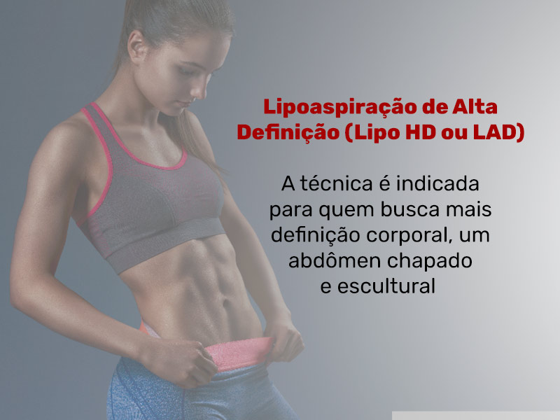 Imagem de uma mulher com a barriga de lipoaspiração HD e os seguintes dizeres: Lipoaspiração de Alta Definição (Lipo HD ou LAD). A técnica é indicada para quem busca mais definição corporal, um abdômen chapado e escultural