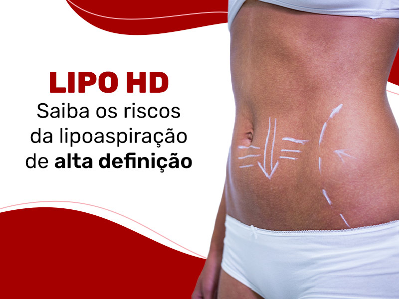 Imagem de uma mulher com marcações na barriga para realizar uma cirurgia plástica e os seguintes dizeres ao seu lado: Lipo HD saiba os riscos da lipoaspiração de alta definição