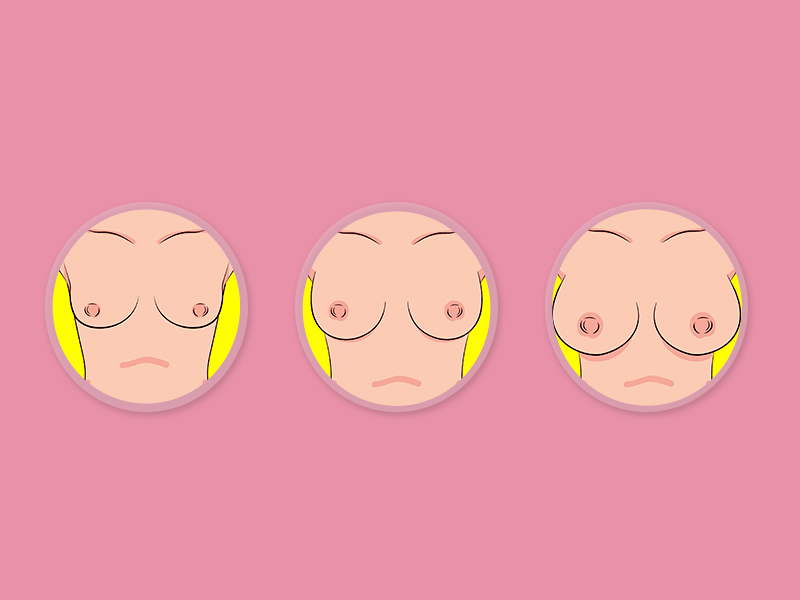 Tamanhos de silicone de mama Ilustração com os tamanhos de silicone de mama diferentes