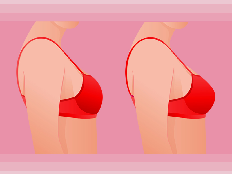 Ilustração com a diferença do Silicone 200ml perfil alto antes e depois