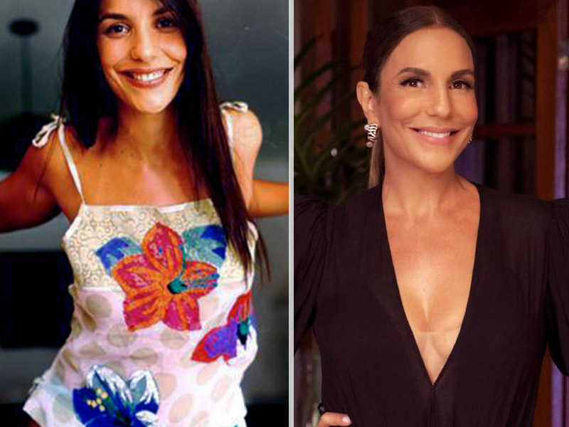 silicone antes e depois 200ml da Ivete Sangalo