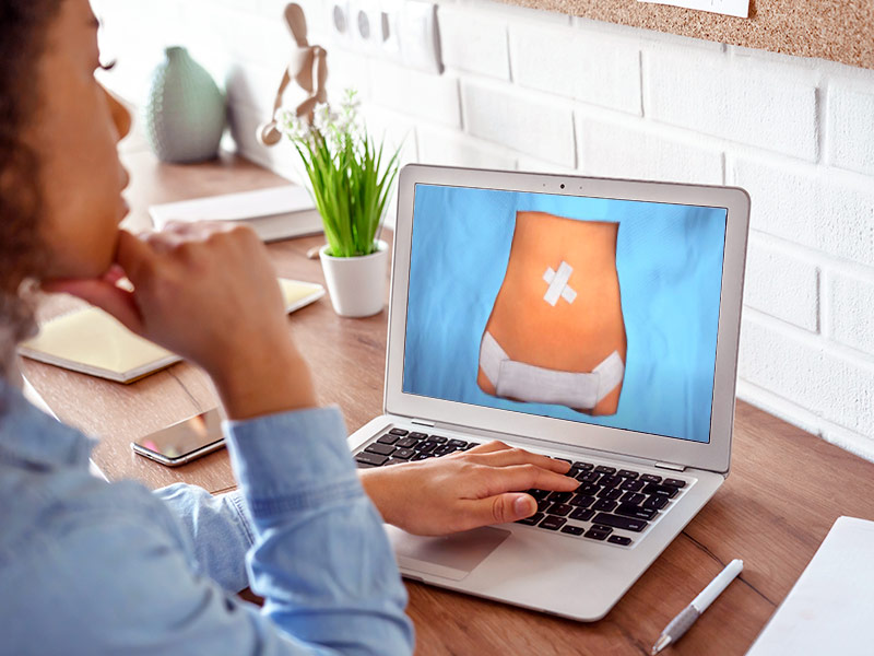Vídeo Abdominoplastia: finalizando o procedimento! vídeo fazendo abdominoplastia passo 6: são colocados os curativos no umbigo e na parte inferior da barriga