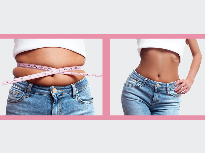 Lipocavitação Antes e Depois lipocavitação antes depois