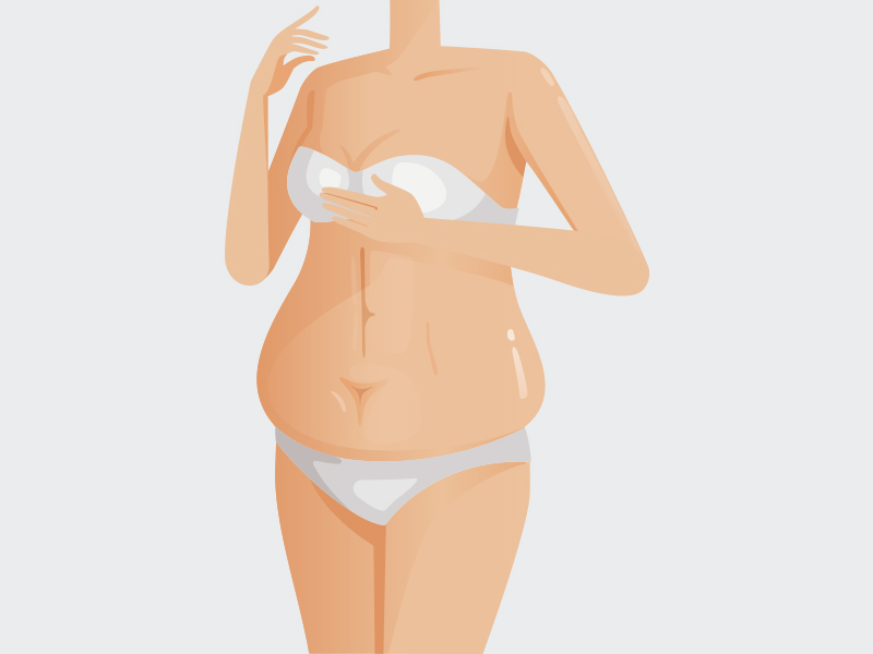 Ganho de peso na Lipo LAD lipo hd antes depois