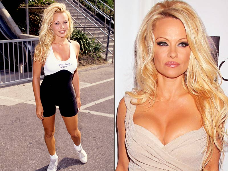 Prótese de silicone 400ml 400 ml de silicone da Pamela Anderson