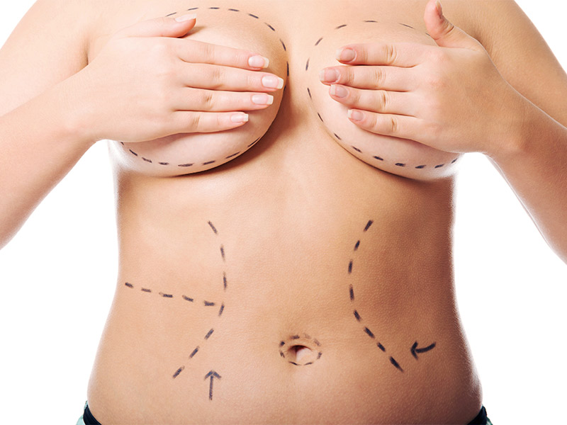 É possível fazer lipo HD com outros procedimentos? procedimentos conjuntos lipo hd