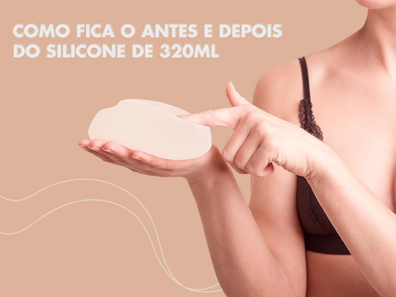 320 ml de silicone fica bom? Veja fotos de antes e depois e dicas valiosas para escolher o tamanho certo! 320 ml silicone