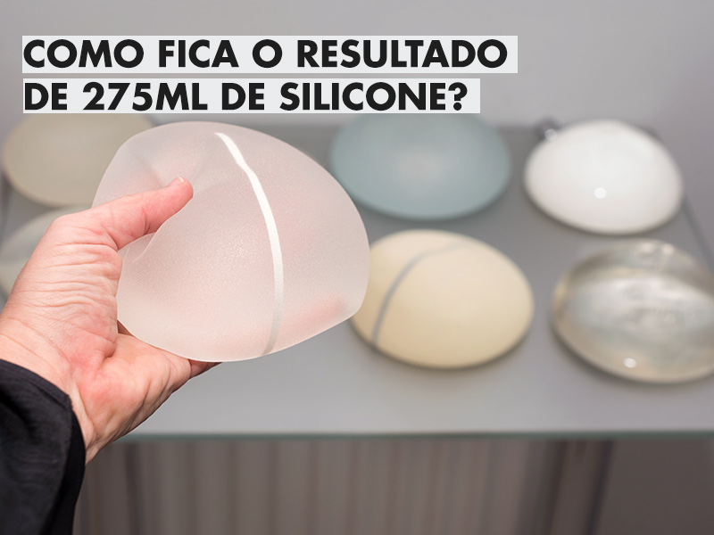 Silicone 275ml: Antes e Depois e dicas essenciais para escolher o melhor tamanho! silicone 275ml antes depois