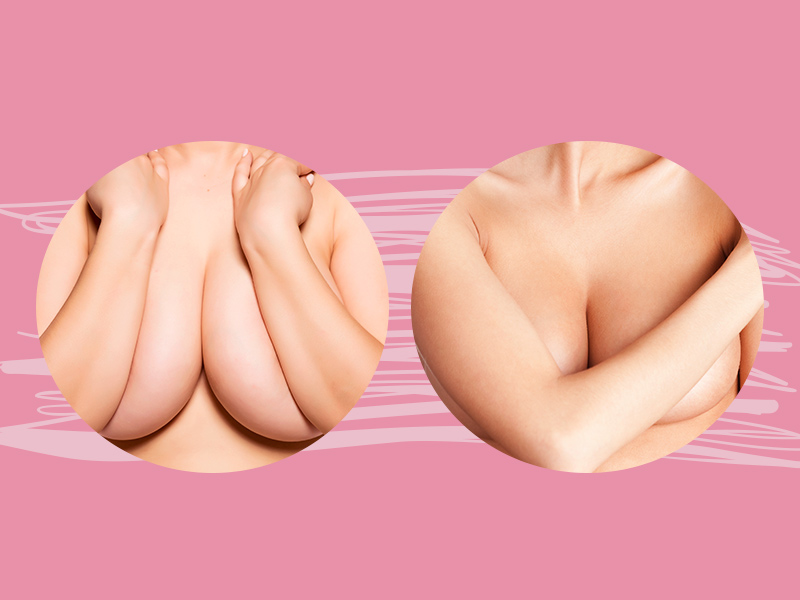Antes e depois da Mastopexia: a cirurgia no peito mastopexia antes depois