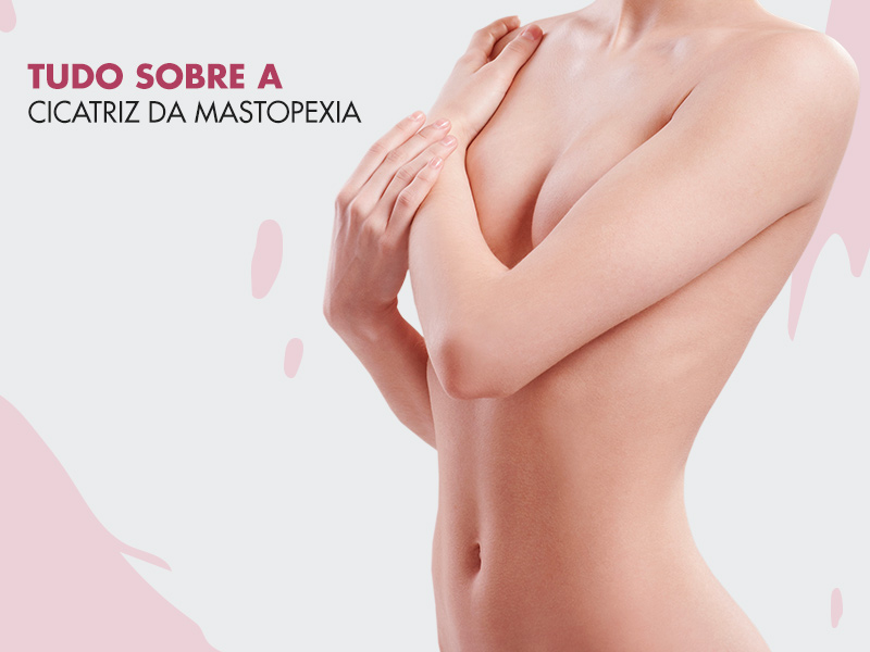 Cicatrizes da mastopexia: veja dicas e cuidados para ter uma cicatrização discreta! mastopexia cicatrizes