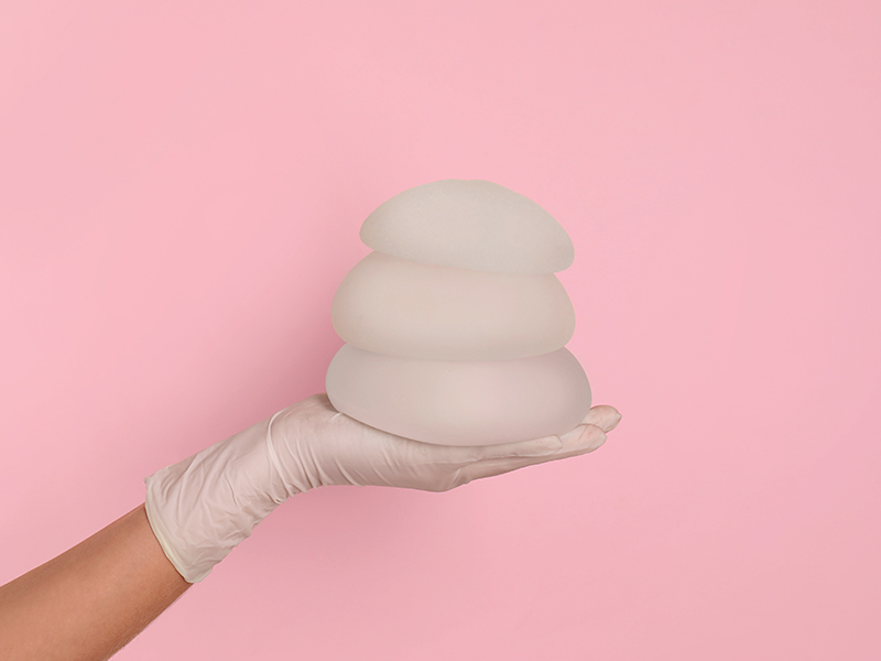 Tamanhos de silicone mais usados na mastopexia, de 250 a 350ml Mão com luva segurando três próteses de silicone de tamanhos diferentes empilhadas uma em cima da outra