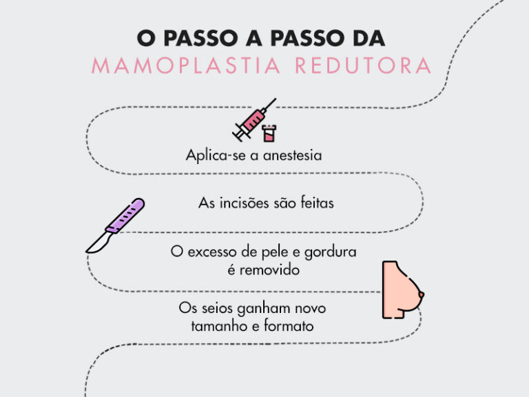 Mamoplastia redutora Tudo sobre l Dream Plastic Mamoplastia redutora Tudo sobre l Dream Plastic
