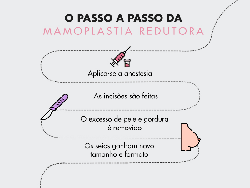 Como é feita a mamoplastia redutora? cirurgia diminuir seios