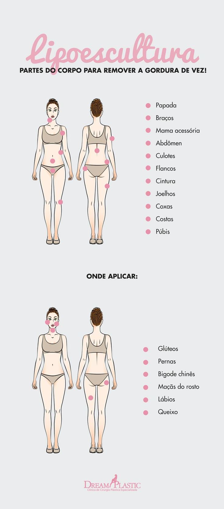 Ilustração mostrando todas as partes do corpo em que a gordura localizada pode ser retirada e reaplicada em outra região através da lipoescultura