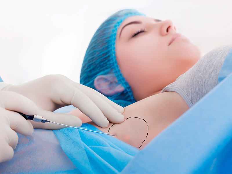 Paciente fazendo a cirurgia de glândula mamaria na axila