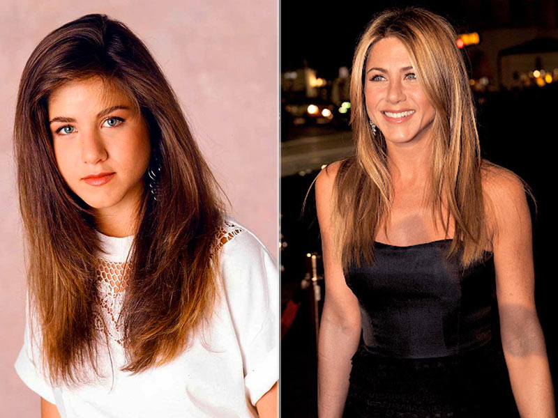 Jennifer Aniston antes, quando era mais nova, e agora, depois da cirurgia de rinosseptoplastia