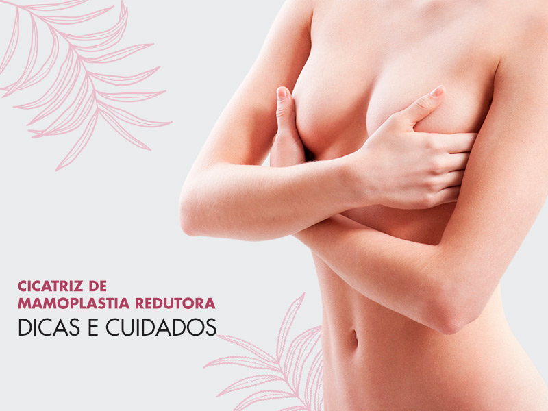 Cicatriz de mamoplastia: descubra como fica e as melhores dicas para uma boa cicatrização! cicatriz mamoplastia