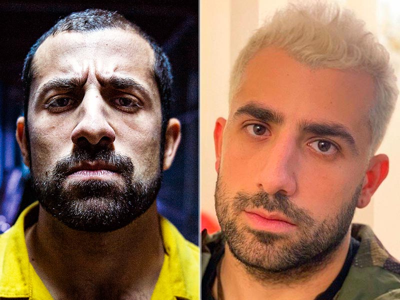 Foto de antes e depois da cirurgia de septoplastia do Kaysar Dadour