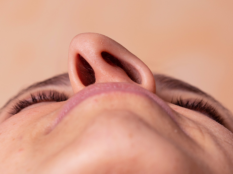 Como funciona a rinoplastia funcional? rinoplastia respiracao